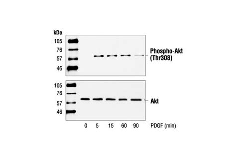 akt protein|akt protein molecular weight.